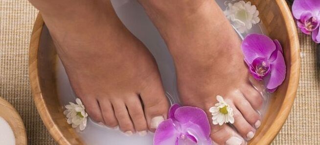 remedios caseros contra las venas varicosas