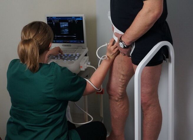 examen de las venas antes de la coagulación con láser para las venas varicosas
