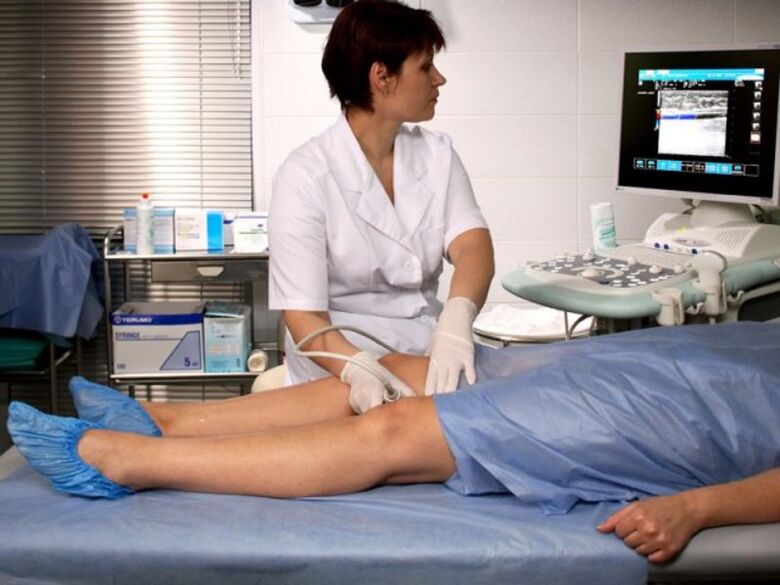 Ultrasonido de las extremidades inferiores para varices.